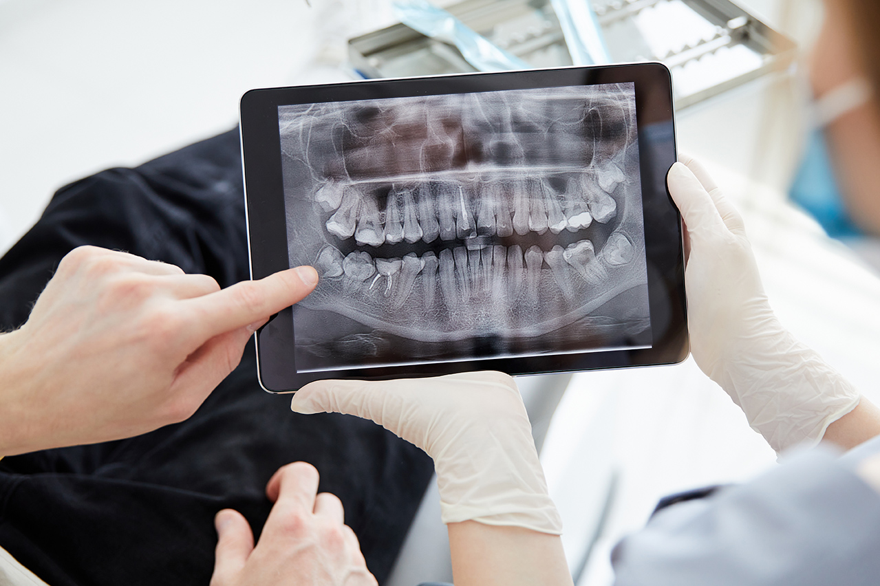 Do. Do pointing to a dental xray during an appoitment for Restorative Dental Care in Medford, MA