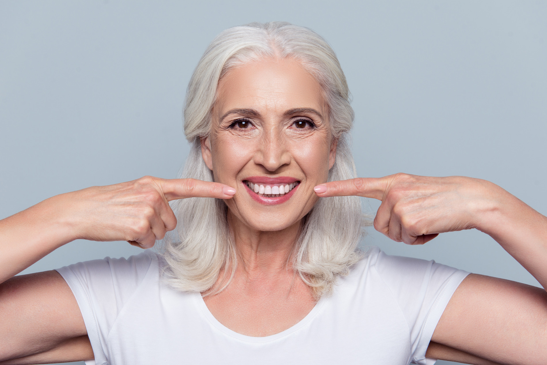 Woman showing of her implant overdentures in Medford MA
